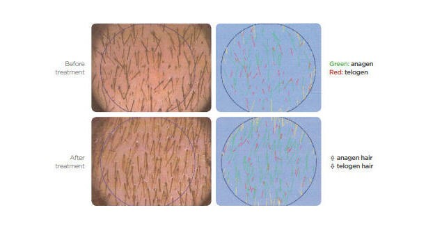 CAPIXYL™ HAIR EYELASH GROWTH PEPTIDE