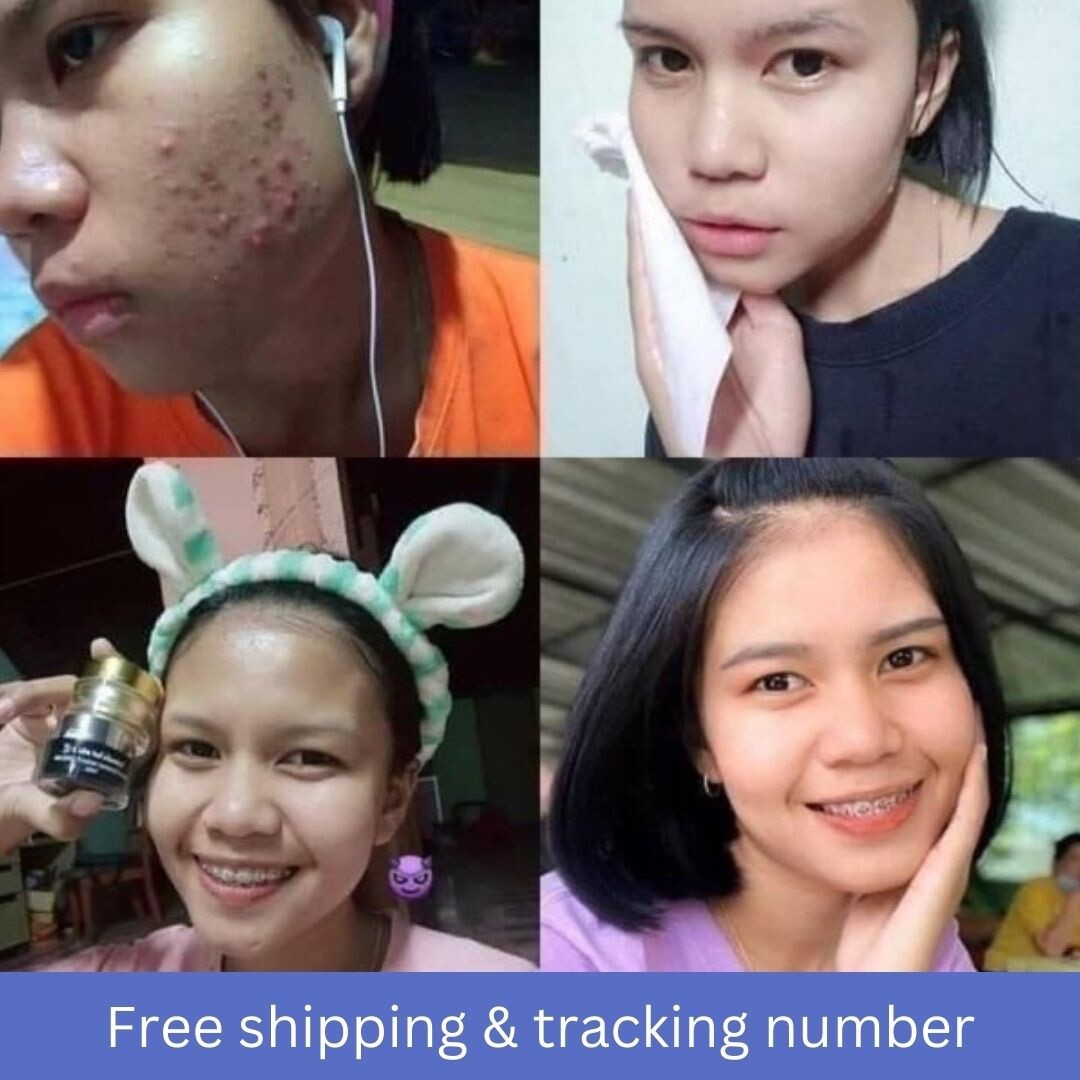 2x RCC Night Cream Smooth Skin+Whitening Reduce Melasmas Wrinkle Scars Acne Mark