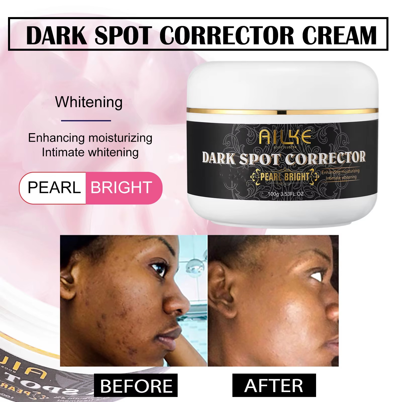 Collagen Women Skin Care Set, Moisturizing, Whitening, Remove Freckles, Dark Spo