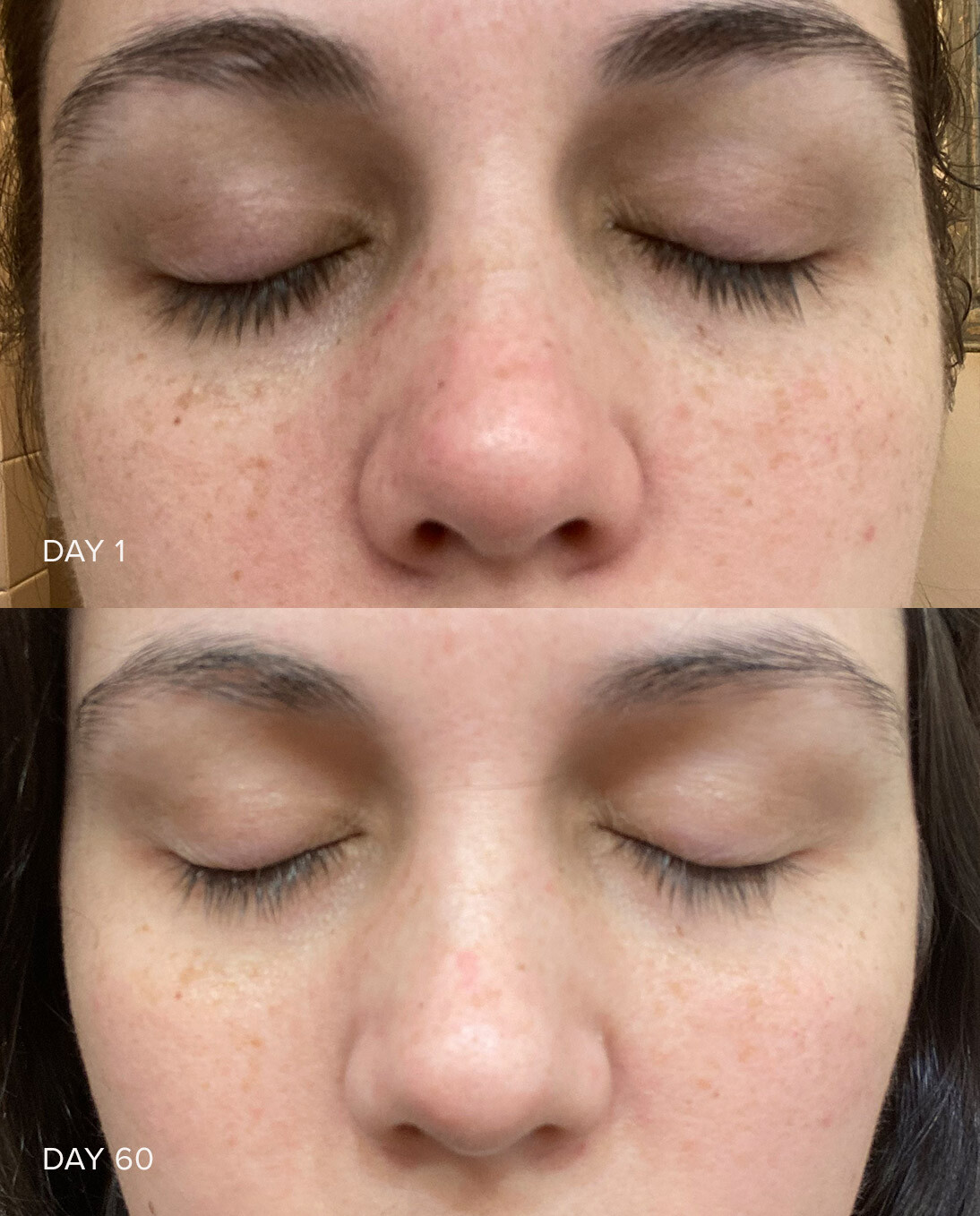 Vitamin C Serum 30% + Ferulic & Hyaluronic Acid – Anti-Ageing Brightening Cream