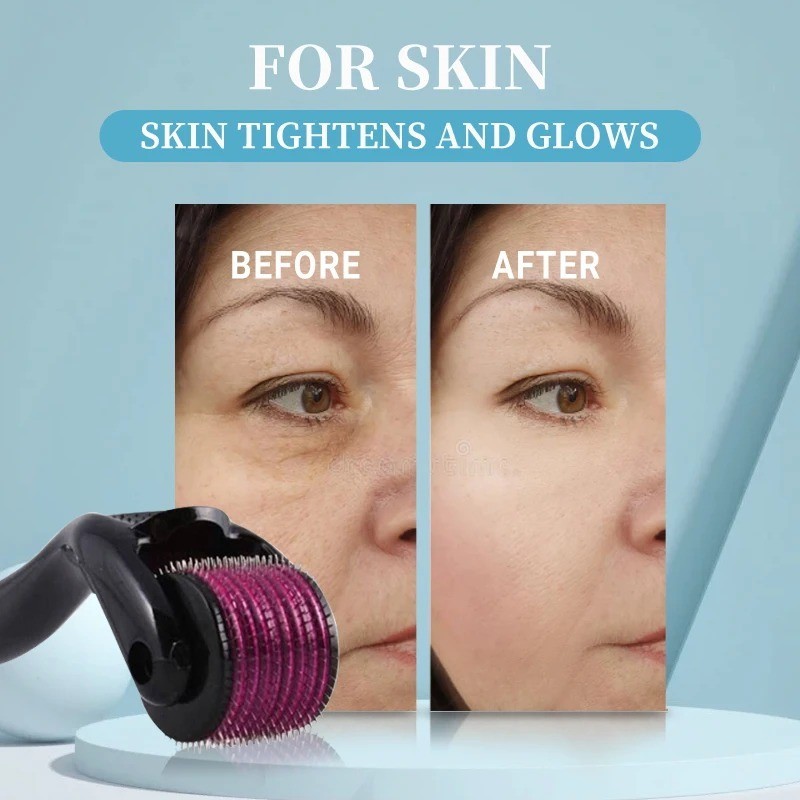 Derma Skin Roller 540 Titanium Micro Needle Anti Ageing Hair Regeneration Growth