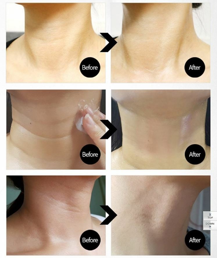 KOREA [MEDIPEEL] Naite Thread Neck Cream 100ml Wrinkle Improvement BEST