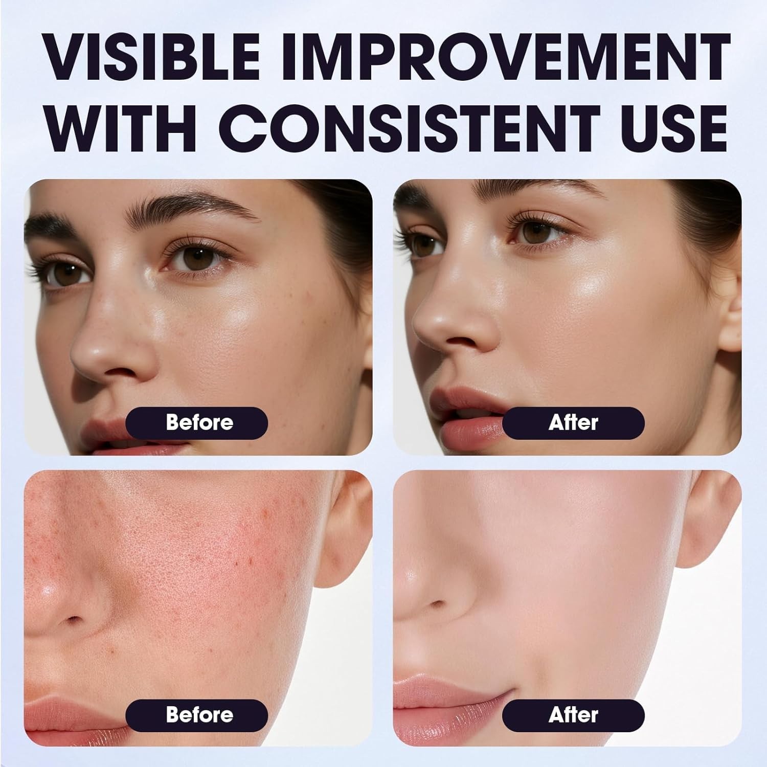 Arbutin 8% & Tranexamic Acid 5% Cream, Help Fade Dark Spots, Freckles, Blemishes
