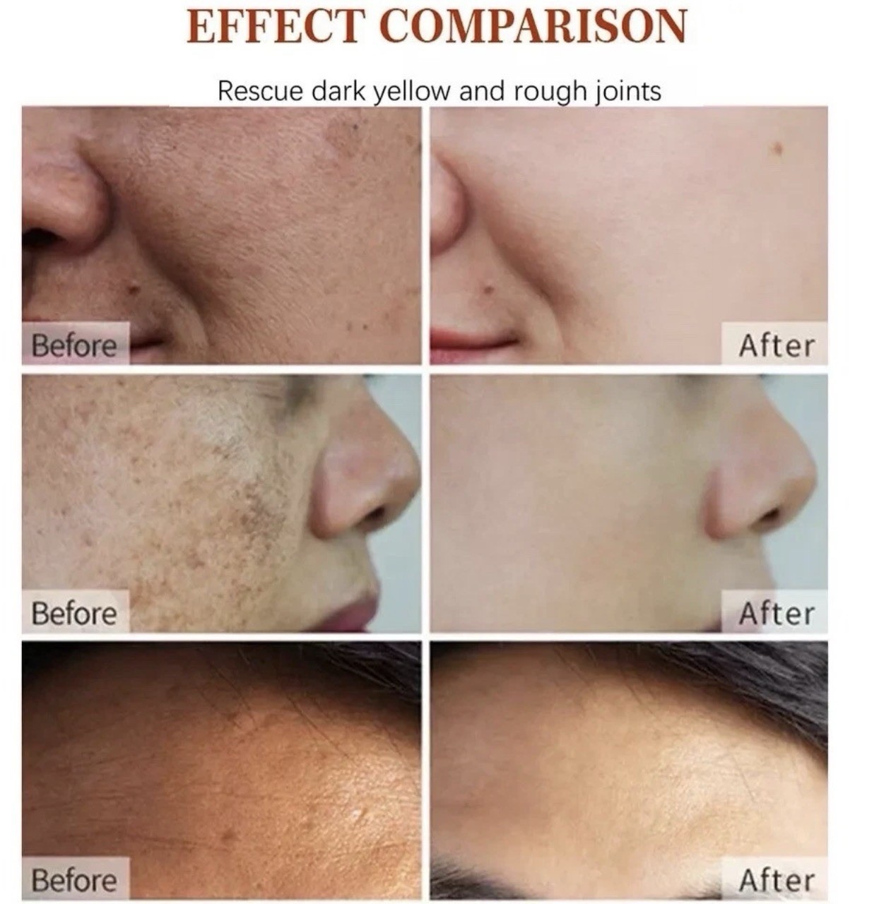 Dark Spot Corrector Face Neck Skin Dark Spot Remover Cream 45% Active Pigment