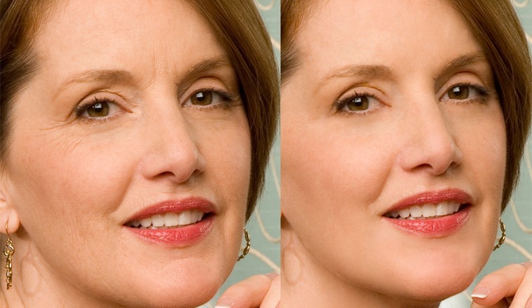 Hyaluronic Acid HA Glycolic Acid CoQ10 Strongest Anti Aging Wrinkle Cream Serum