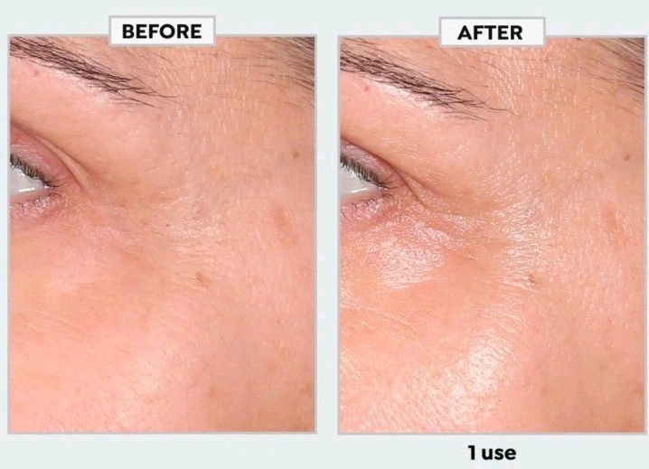 SKINN Age Reset Illuminate + Firm Eye Serum w/Exosomes-.5 fl oz-New Sealed