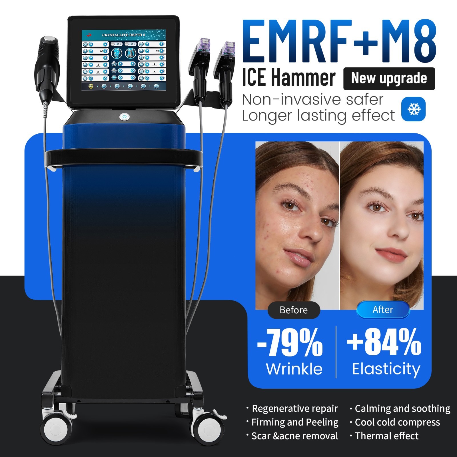 3 in 1 Professional Face Lift Body Slim Skin Firm Skin Rejuvenation Machine