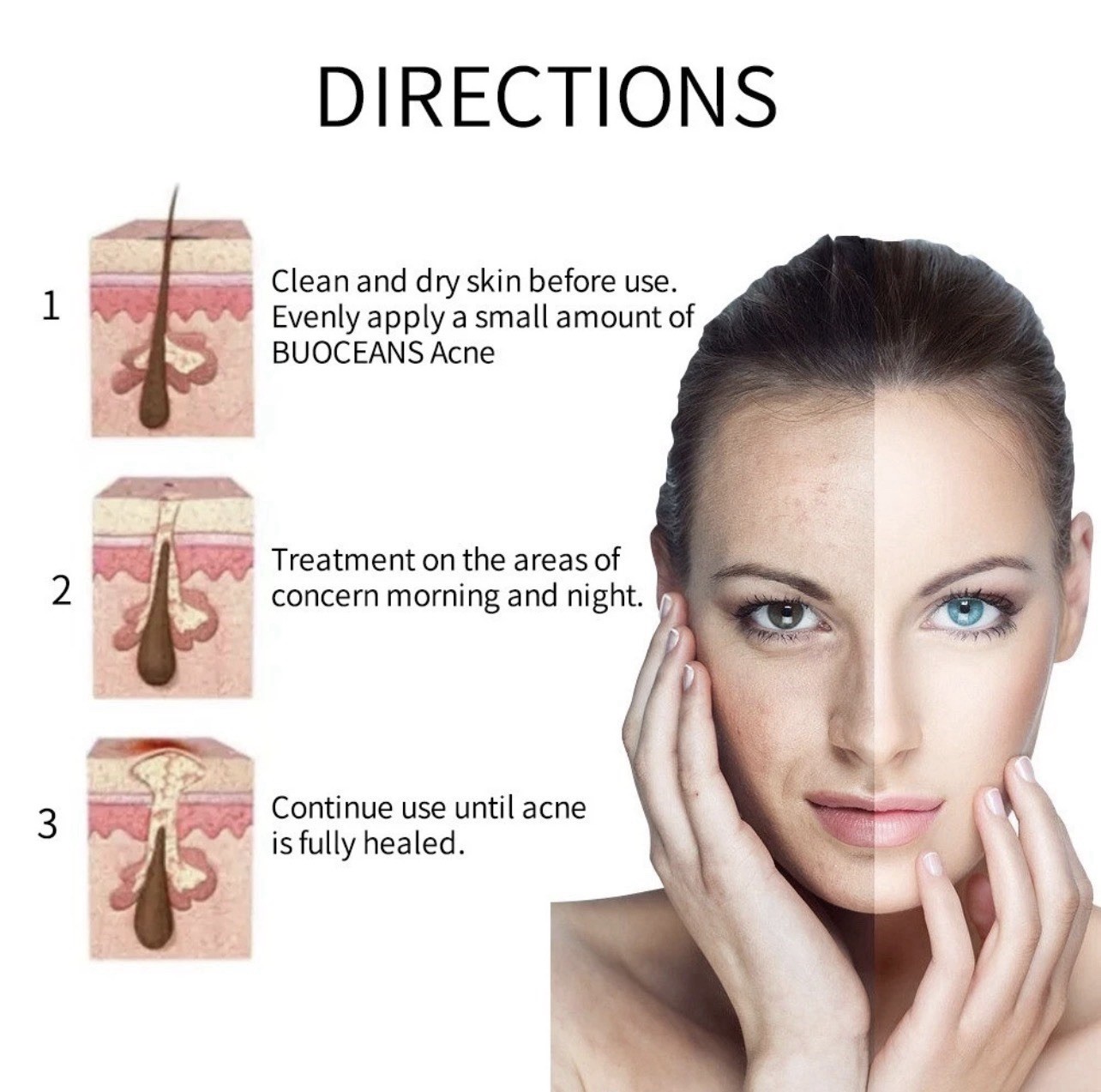 Dark Spot Corrector Face Neck Skin Dark Spot Remover Cream 45% Active Pigment
