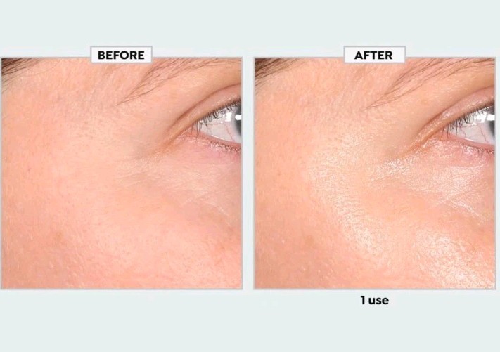 SKINN Age Reset Illuminate + Firm Eye Serum w/Exosomes-.5 fl oz-New Sealed