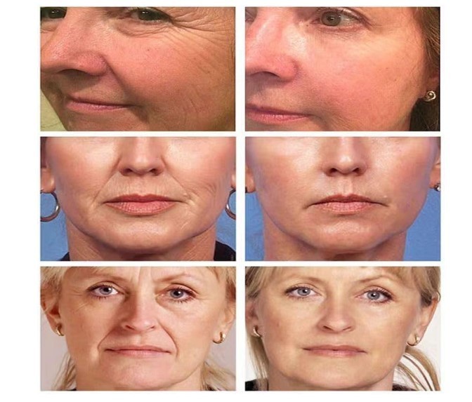 3 Pack Retinol & Peptide Tightening Cream for Smooth Firm-Looking Skin
