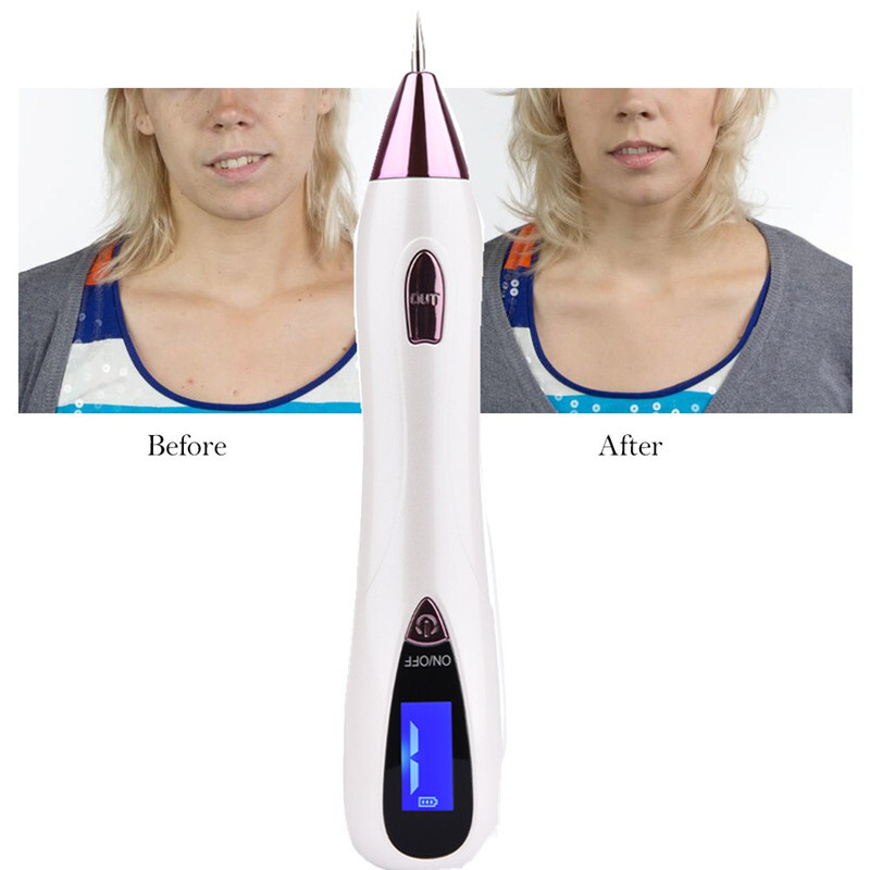 Laser Plasma Pen Skin Tag Mole Freckle Removal Dark Spot Tattoo Wart Remover Pen