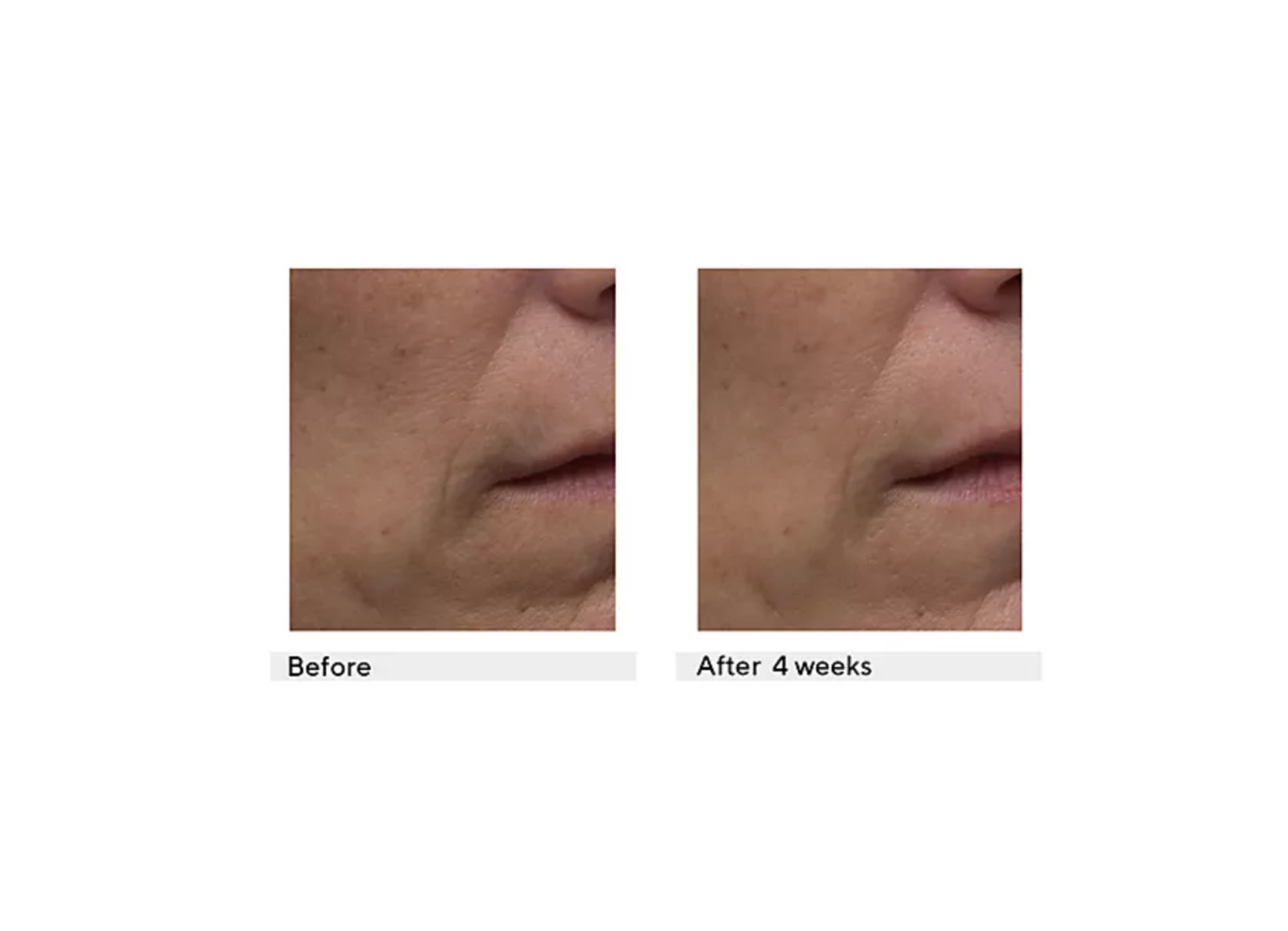 Dr. Denese 100-count Advanced Firming Facial Pads