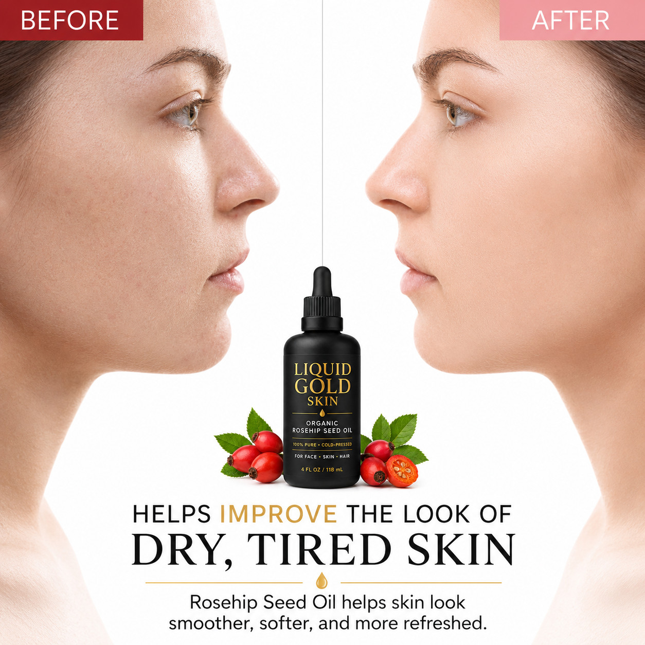 LIQUID GOLD SKIN Organic Rosehip Seed Oil 100% Pure • Face, Skin & Hair