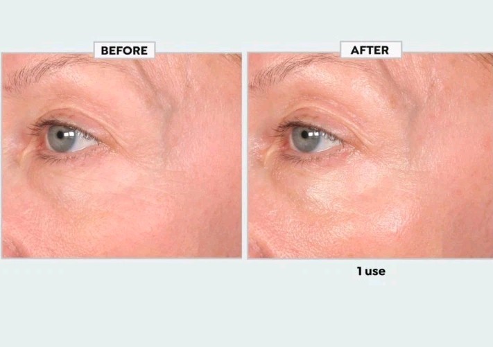 SKINN Age Reset Illuminate + Firm Eye Serum w/Exosomes-.5 fl oz-New Sealed