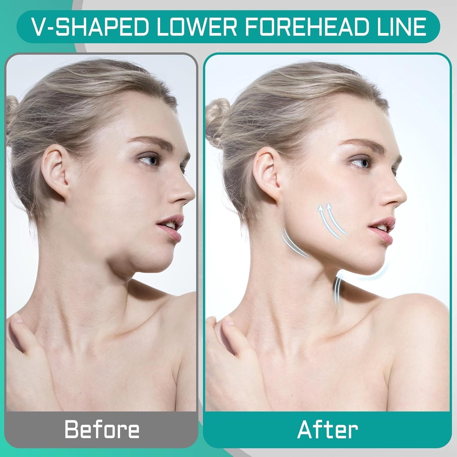 Jaw Trainer – Jawline Exerciser for Men & Women with 4 Resistance Levels