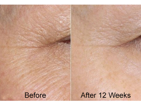 VITAMIN C + RETINOL – Anti-Aging Anti-Wrinkle Fine Line Gel-Cream-Serum 2-Pack