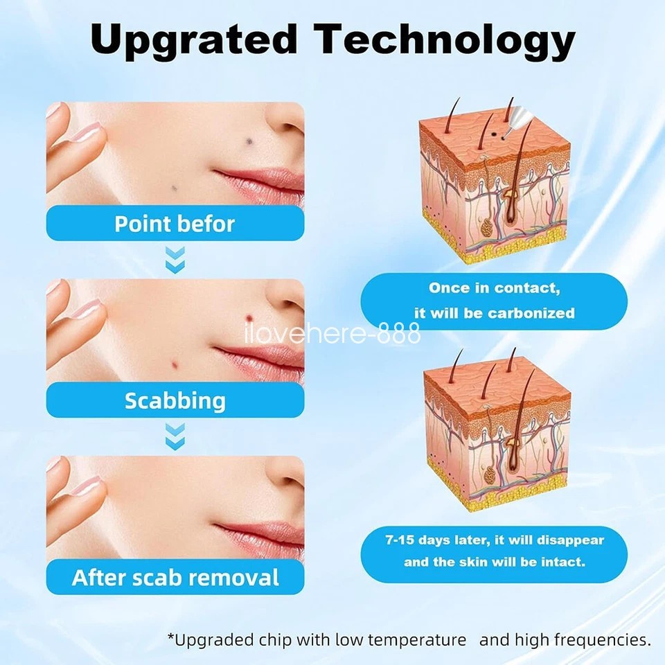 High Quality Wrinkle Removal Plasma Pen Skin Care Anti-Aging Skin Rejuvenation