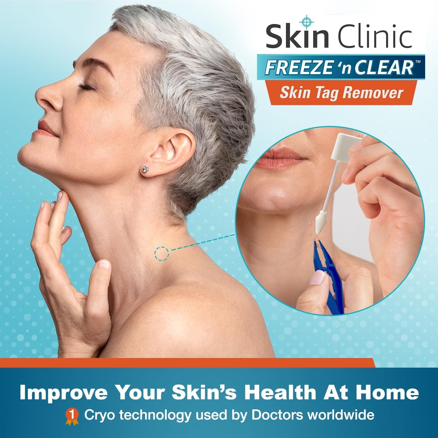 Skin Tag Remover – Cryogenic Kit with 8 Precision-Tip Applicators + Tweezers …