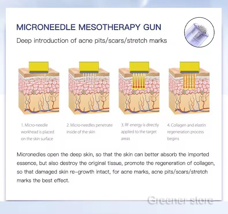 Micro Meso-Pen Acne Wrinkle Removal Therapy Gun with 10Pcs 24Pin Cartridges Tips