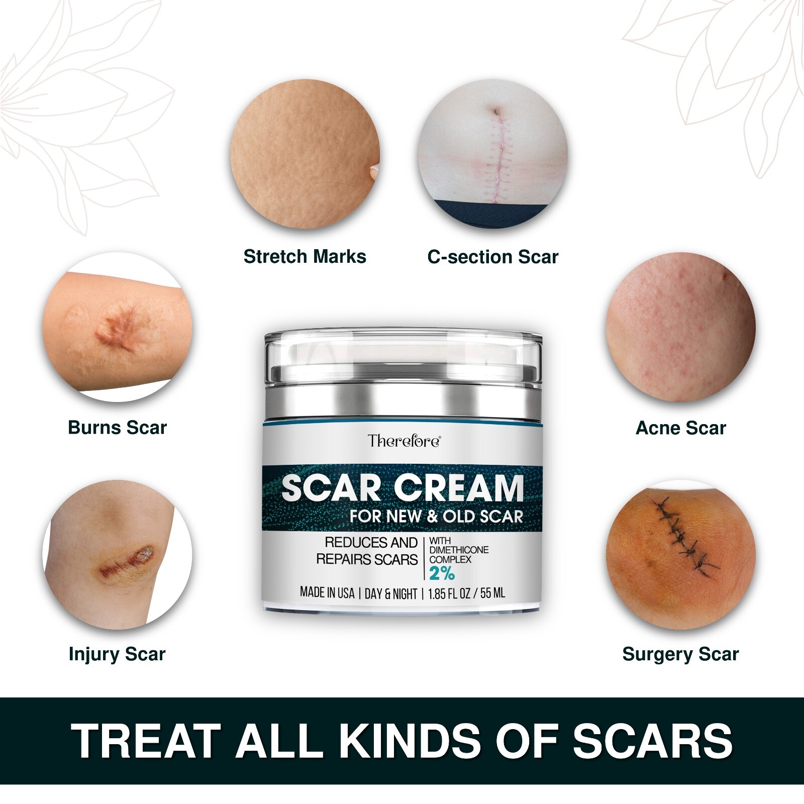 Advanced Scar Cream for Face and Body – Old & New Scar Removal Treatment 1.86 oz