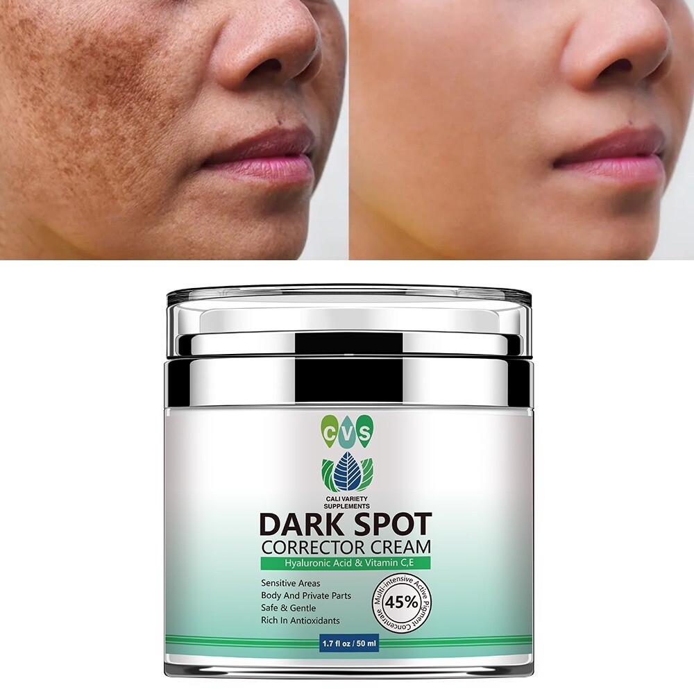 Dark Spot Corrector Face Neck Skin Dark Spot Remover Cream 45% Active Pigment