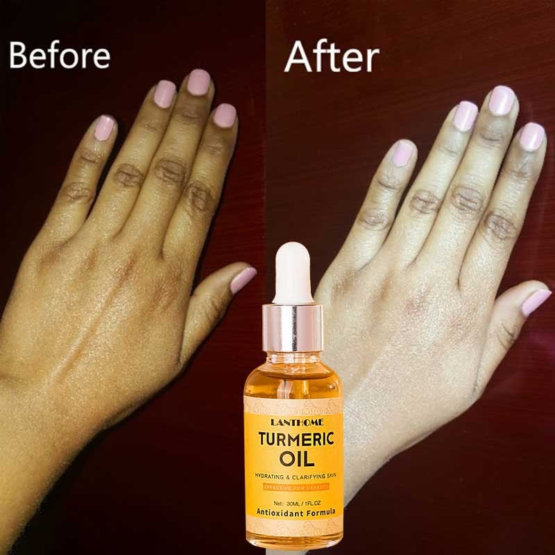 3PCS Turmeric Face Care Kit Skin Brightening Turmeric Soap Whitening Oil